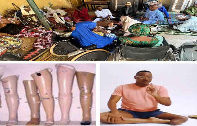 2024 Limb Loss Day: Millions of Nigerian amputees face soaring prosthetic costs – NAPWPD 